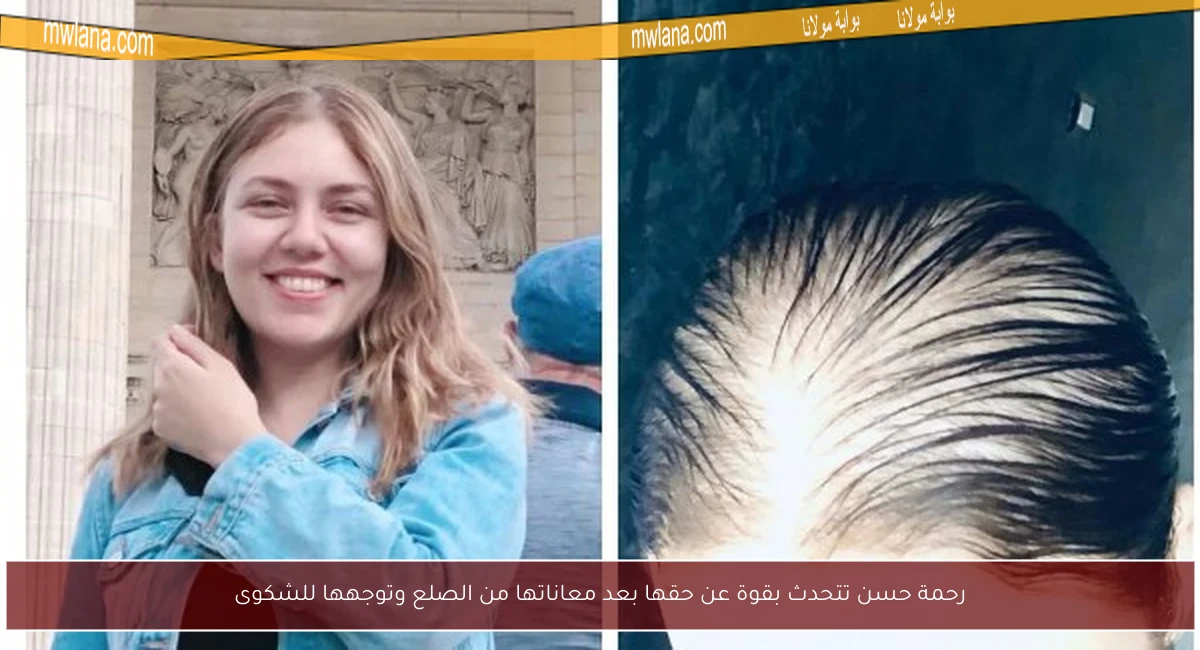 رحمة حسن تتحدث بقوة عن حقها بعد معاناتها من الصلع وتوجهها للشكوى