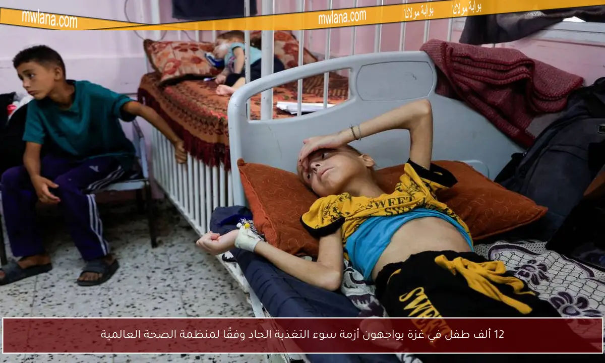 12 ألف طفل في غزة يواجهون أزمة سوء التغذية الحاد وفقًا لمنظمة الصحة العالمية