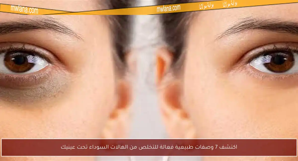 اكتشف 7 وصفات طبيعية فعالة للتخلص من الهالات السوداء تحت عينيك