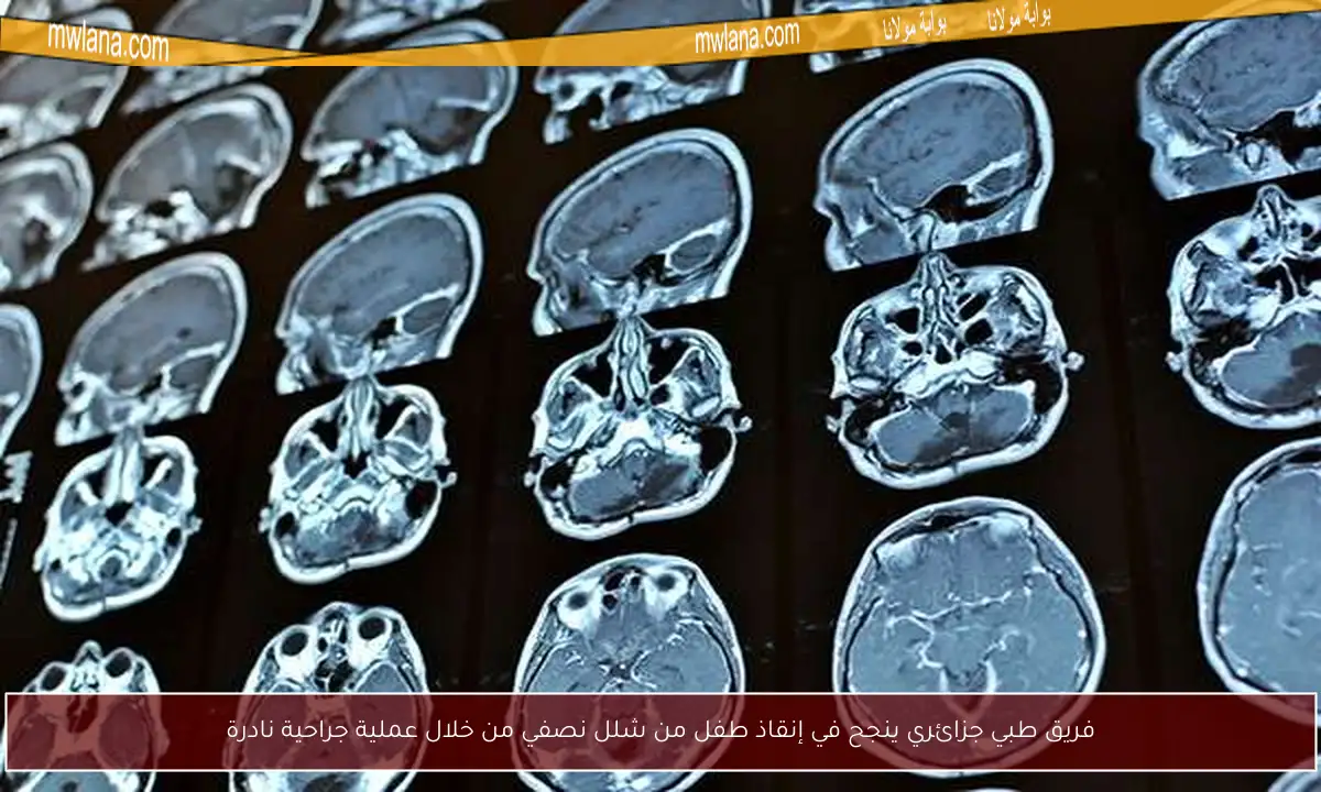 فريق طبي جزائري ينجح في إنقاذ طفل من شلل نصفي من خلال عملية جراحية نادرة